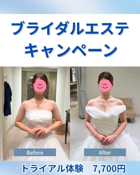 ブライダルエステ体験