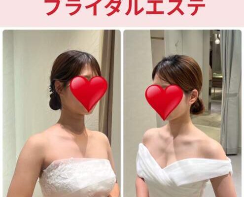 ブライダルエステナイスレポンド