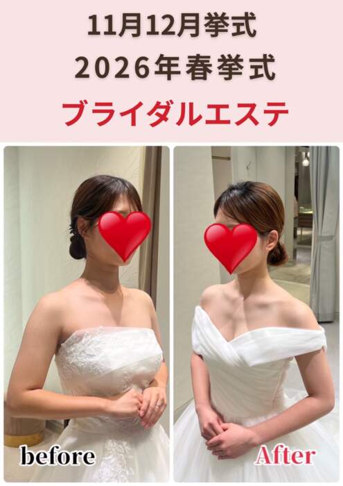 ブライダルエステナイスレポンド